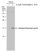 Anti-Histone H3K27ac (Acetyl Lys27) antibody [GT261] used in Western Blot (WB). GTX633652